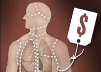 organ harvesting