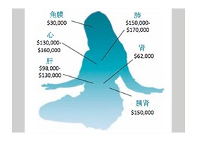 2014-7-20-organ-harvesting-profits