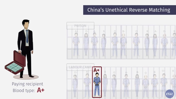 China's Unethical Organ Transplant