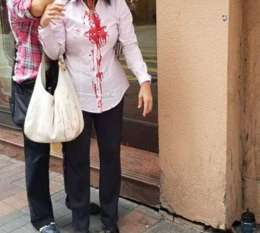 Ms. Liao Qiulan was brutally attacked by two masked assailants on September 24, 2019.