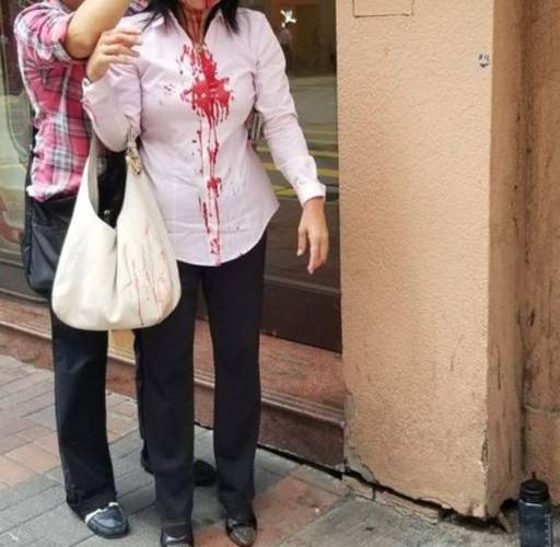Ms. Liao Qiulan was brutally attacked by two masked assailants on September 24, 2019.