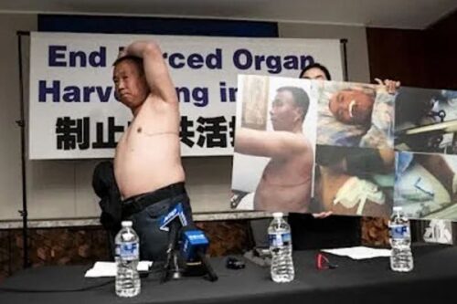 Falun Gong practitioner Cheng Peiming narrates his experience and shows his 35-cm scar as a result the CCP’s forced organ harvesting during a press conference in Washington DC on July 3, 2024. (Screenshot of NTDTV video)